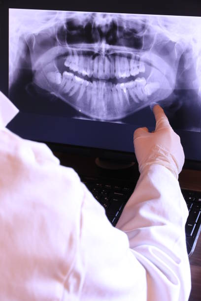 Best Emergency Gum Treatment in Frazer, PA